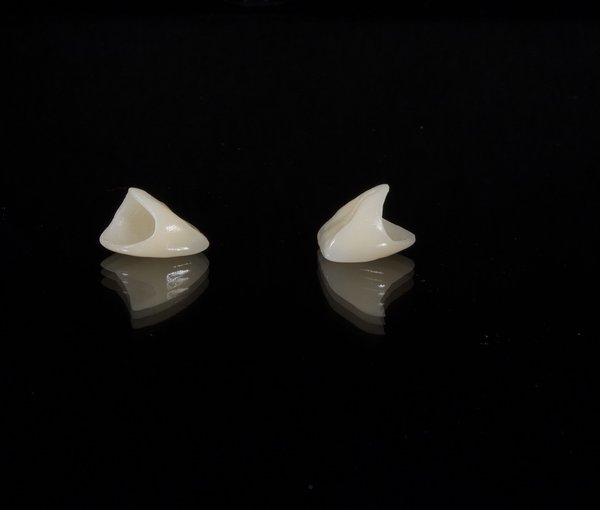 Oral Implants